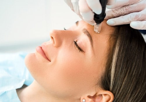 Services Microneedling